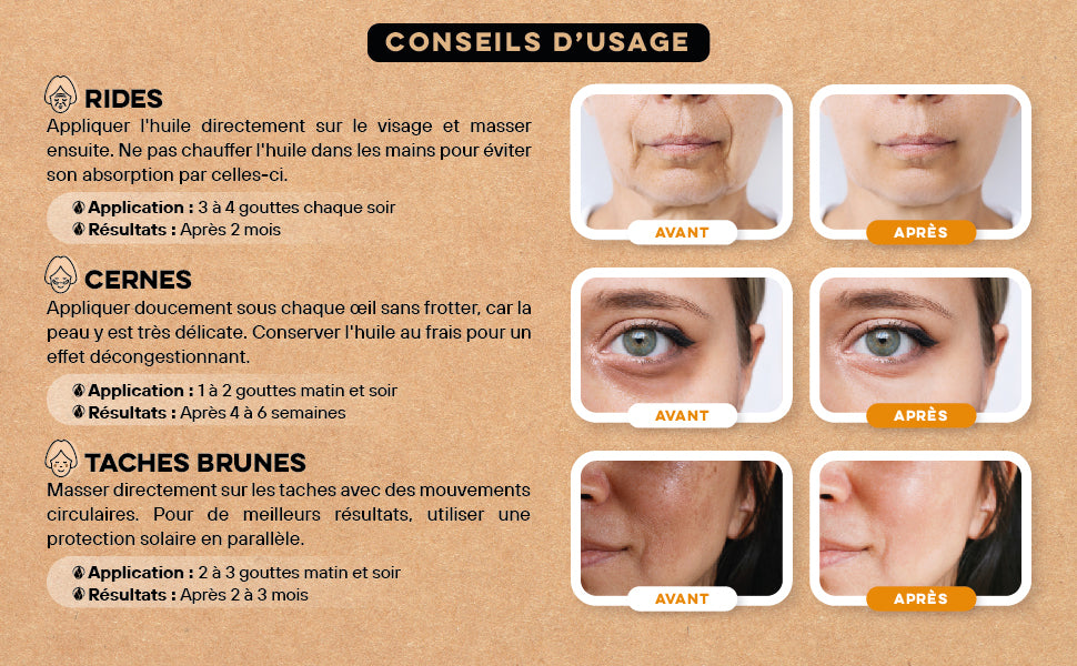 alt="Soin naturel visage anti-rides – huile de figue de barbarie bio 20ml"