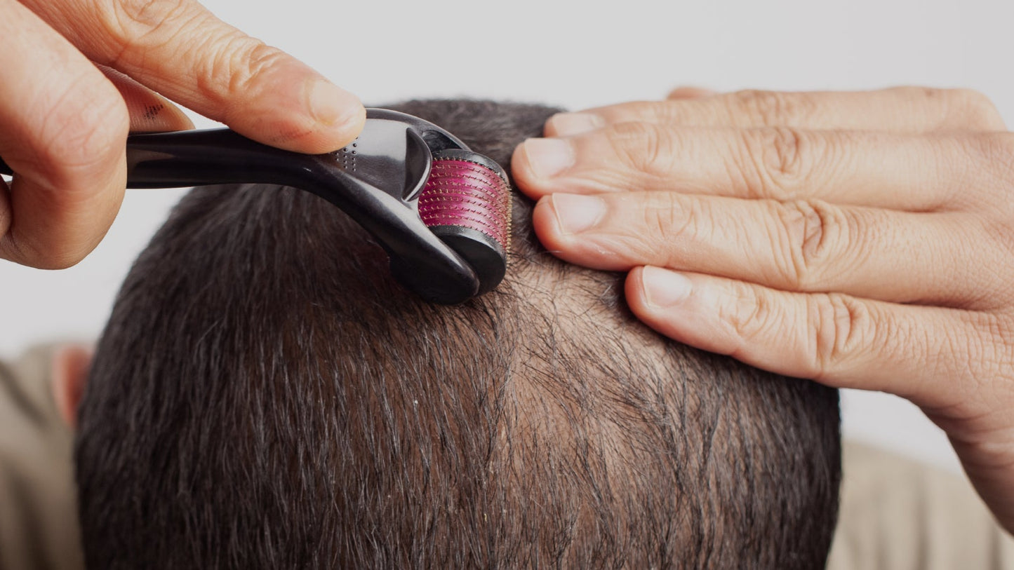 <img src="dermaroller-professionnel.jpg" alt="Dermaroller 0.5mm à micro-aiguilles en titane pour stimulation capillaire et repousse des cheveux">